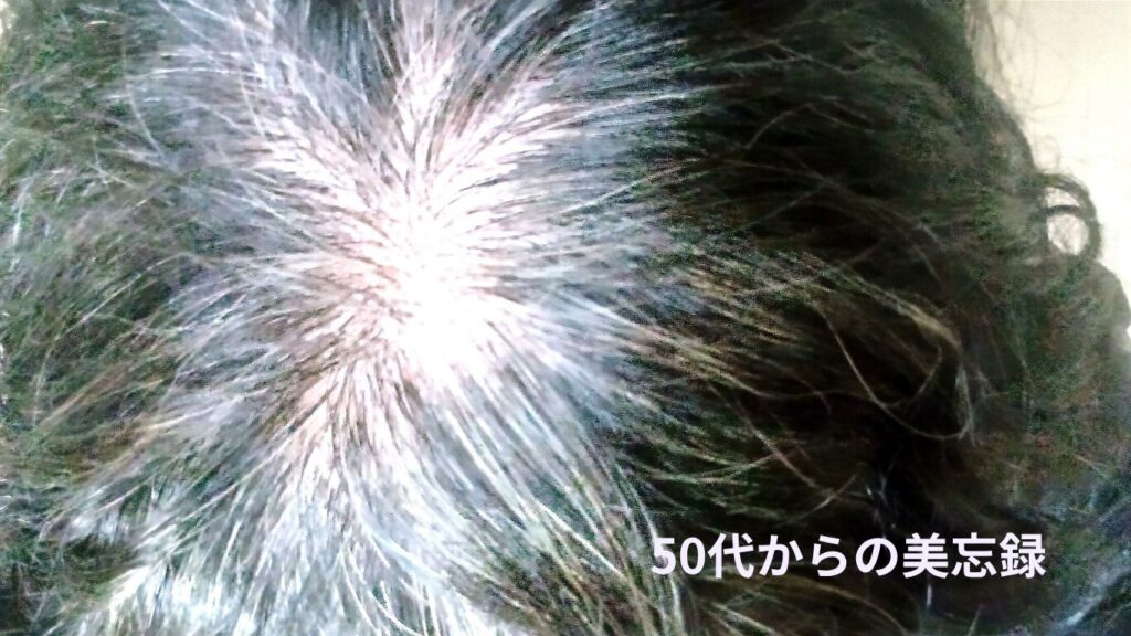 50代の地肌が透けて見える頭頂部のつむじ